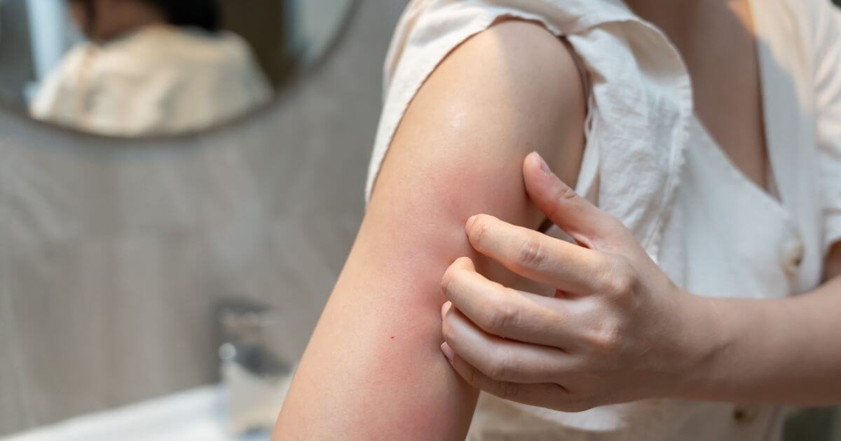 Skin irritation on the arm, illustrating inflammatory symptoms linked to gut health
