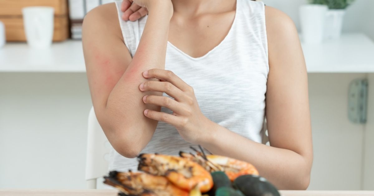 Person scratching arm with food nearby